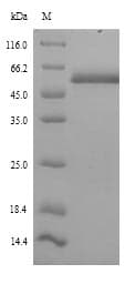 Human ICA69 / ICA1 Protein (Recombinant 6His, N-terminus)