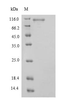 Human STAT3 Protein (Recombinant 6His, N-terminus)
