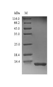 Rat Complement C3 Protein (Recombinant 6His, N-terminus)