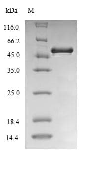 Burkholderia cepacia lpxC / asmB / envA Protein (Recombinant 6His-SUMO, N-terminus + Myc, C-terminus)