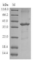 Human E-FABP / FABP5 Protein (Recombinant GST, N-terminus)