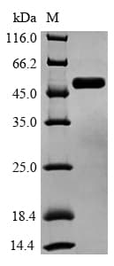 Human GSK3B / GSK3 Beta Protein (Recombinant 6His, N-terminus)