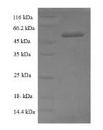 Influenza A Virus Influenza A H5N1 M2 Protein (Recombinant 6His, N-terminus)