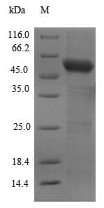 Human C6orf150 / MB21D1 Protein (Recombinant 6His-SUMO, N-terminus)