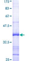Human AKR1B1 / Aldose Reductase Protein (Recombinant GST, N-terminus)