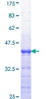 Human APC Protein (Recombinant GST, N-terminus)