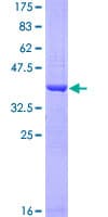 Human APLP2 Protein (Recombinant GST, N-terminus)