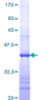 Human CD8A / CD8 Alpha Protein (Recombinant GST, N-terminus)