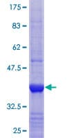 Human LYST Protein (Recombinant GST, N-terminus)