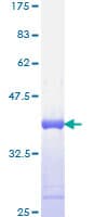 Human CSF1 / MCSF Protein (Recombinant GST, N-terminus)