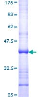 Human DIO2 Protein (Recombinant GST, N-terminus)