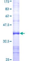 Human FAP Alpha Protein (Recombinant GST, N-terminus)