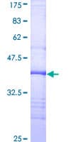 Human CD32B Protein (Recombinant GST, N-terminus)