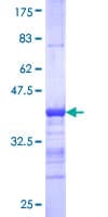 Human LIMK2 Protein (Recombinant GST, N-terminus)