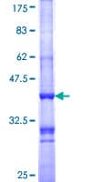 Human MC1R Protein (Recombinant GST, N-terminus)