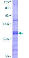 Human MFAP4 Protein (Recombinant GST, N-terminus)