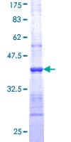 Human NOS1 / nNOS Protein (Recombinant GST, N-terminus)