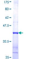 Human NOS2 / iNOS Protein (Recombinant GST, N-terminus)