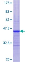 Human PYGM Protein (Recombinant GST, N-terminus)
