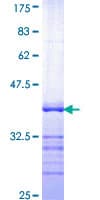 Human SRF / Serum Response Factor Protein (Recombinant GST, N-terminus)