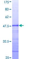 Human STAT2 Protein (Recombinant GST, N-terminus)