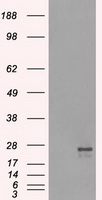 TSC501 / NAT8 Antibody (clone OTI6H3)