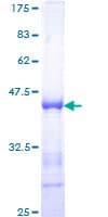 Human SF1 Protein (Recombinant GST, N-terminus)