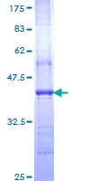 Human Nor-1 / NR4A3 Protein (Recombinant GST, N-terminus)