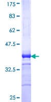 Human DDX3Y Protein (Recombinant GST, N-terminus)
