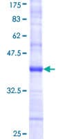Human PDGF-D Protein (Recombinant GST, N-terminus)