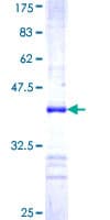 Human RICTOR Protein (Recombinant GST, N-terminus)