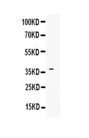 IGFBP3 Antibody