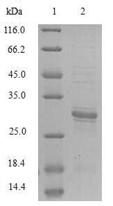 Escherichia coli tsaE Protein (Recombinant DDK,C-terminus)
