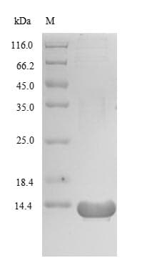 Mycobacterium tuberculosis glcB Protein (Recombinant)