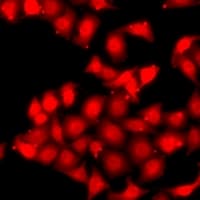Polyclonal Rabbit anti-Human PRKAA2 / AMPK Alpha 2 Antibody (IF, WB)