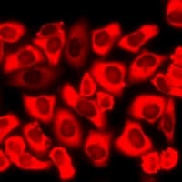 Polyclonal Rabbit anti-Human CHRM2 / M2 Antibody (IF, WB)