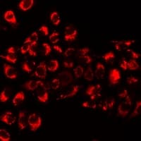 Polyclonal Rabbit anti-Human GIF / Intrinsic Factor Antibody (IF, WB)