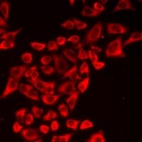 Polyclonal Rabbit anti-Human HYOU1 / ORP150 Antibody (IF, WB)