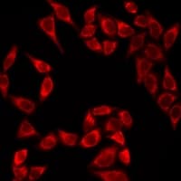 Polyclonal Rabbit anti-Human THADA Antibody (IF, WB)