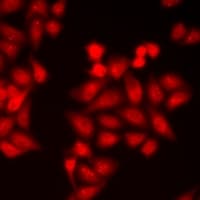 Polyclonal Rabbit anti-Human PTK6 / BRK Antibody (IHC, IF, WB)