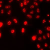 Polyclonal Rabbit anti-Human HIST3H3 Antibody (IHC, IF, WB)