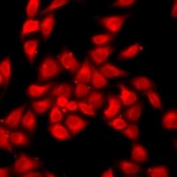 Polyclonal Rabbit anti-Human OAS1 Antibody (IHC, IF, WB)