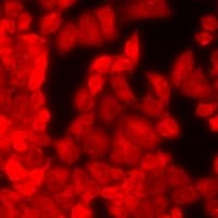 Polyclonal Rabbit anti-Human REG3A Antibody (IHC, IF, WB)