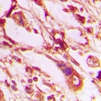 Polyclonal Rabbit anti-Human ALOX15 / 15-Lipoxygenase Antibody (IHC, WB)