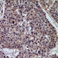 Polyclonal Rabbit anti-Human CD45 / LCA Antibody (IHC, WB)