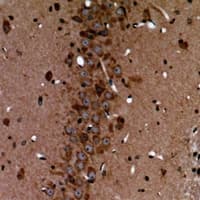 Polyclonal Rabbit anti-Human CHRNB2 Antibody (IHC, WB)