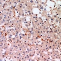 Polyclonal Rabbit anti-Human Complement C3 Antibody (IHC, WB)