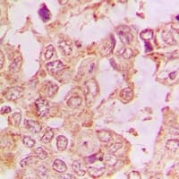 Polyclonal Rabbit anti-Human DNM2 / Dynamin-2 Antibody (IHC, WB)