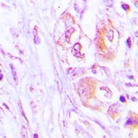 Polyclonal Rabbit anti-Human E-FABP / FABP5 Antibody (IHC, WB)