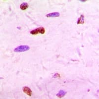 Polyclonal Rabbit anti-Human GATA2 Antibody (IHC, WB)